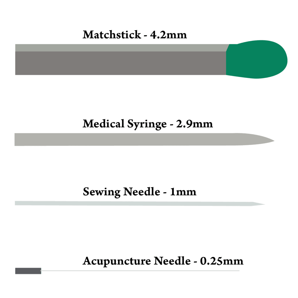 Acupuncture Needle Guide | Tigard Chiropractor | Rhodes Chiropractic