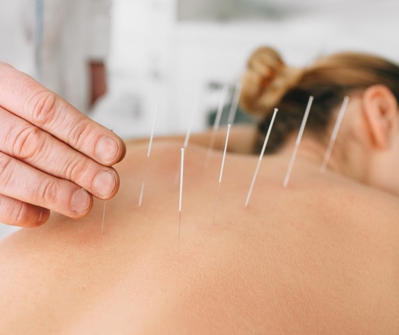 Tigard Chiropractor - Acupuncture - New Patient Free Massage